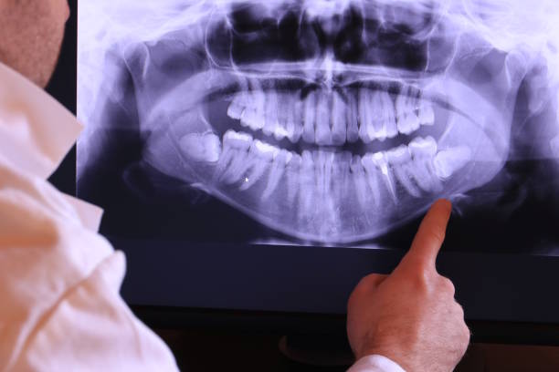 Best Emergency Gum Pain Relief  in Bell Gardens, CA